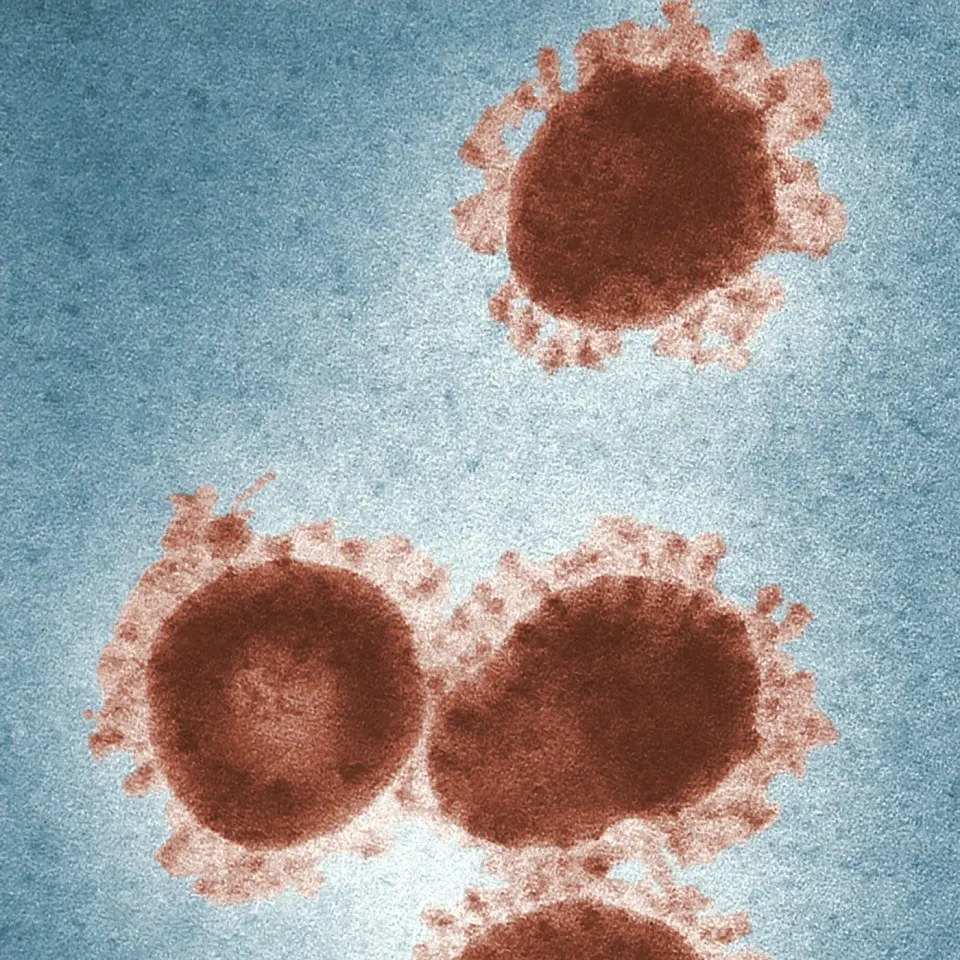 Micrographie colorisée de particules virales